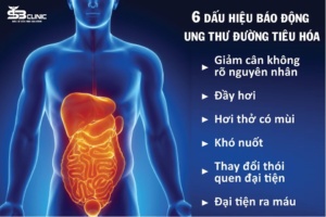 Công dụng của gừng, đối với ung thư đường tiêu hóa