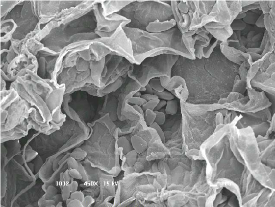 Cấu trúc xenluloza tinh bột trong củ nghệ khô xay nhuyễn được quan sát bằng kính hiển vi điện tử quét (SEM) ở độ phóng đại 450 ×.