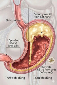 Sơ đồ cắt lớp khi được lớp gel tinh bột nghệ bao phủ