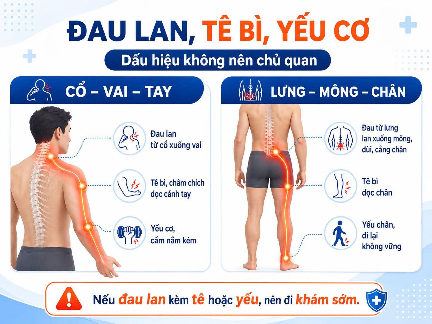 Sơ đồ đau lan từ cổ xuống tay và từ lưng xuống chân kèm tê bì, châm chích, yếu cơ