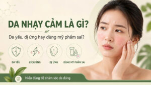 Da nhạy cảm là gì, minh họa da yếu, kích ứng, dị ứng và dùng mỹ phẩm sai gây đỏ rát, châm chích