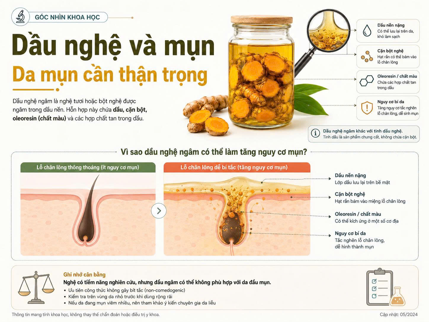 Infographic về dầu nghệ và mụn, minh họa hũ nghệ ngâm trong dầu nền và nguy cơ dầu nền nặng, cặn bột nghệ, oleoresin gây bí lỗ chân lông.