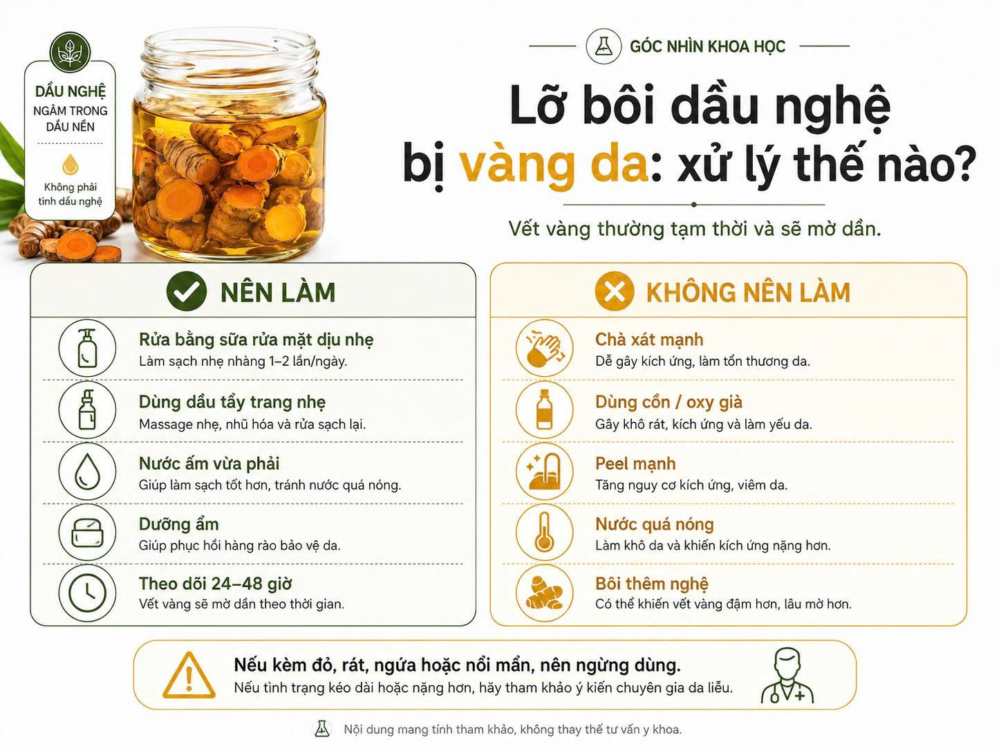 Infographic hướng dẫn xử lý khi bôi dầu nghệ bị vàng da, gồm những việc nên làm và không nên làm để tránh kích ứng da.