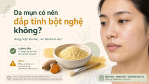 Da mụn có nên đắp tinh bột nghệ không và khi nào nên dùng hoặc nên tránh